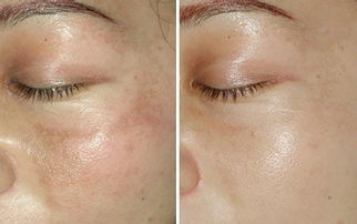 ảnh trước khi sử dụng oribe