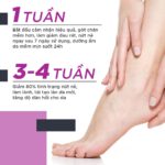 KEM NỨT GÓT ORISS - Kem Dưỡng Ẩm Làm Mềm Gót Chân Chống Nứt Nẻ Làm Liền Vết Thương 30g