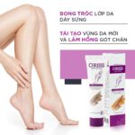KEM NỨT GÓT ORISS - Kem Dưỡng Ẩm Làm Mềm Gót Chân Chống Nứt Nẻ Làm Liền Vết Thương 30g