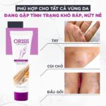 KEM NỨT GÓT ORISS - Kem Dưỡng Ẩm Làm Mềm Gót Chân Chống Nứt Nẻ Làm Liền Vết Thương 30g