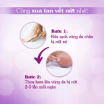 hướng dẫn sử dụng kem nứt gót oriss