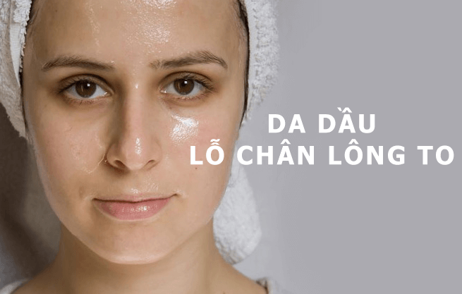 Da dầu là nguyên nhân khiến lỗ chân lông to ra.