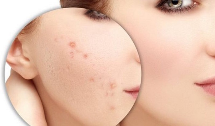 Kem dưỡng da có sẽ làm lỏng lẻo liên kết hắc sắc tố da.