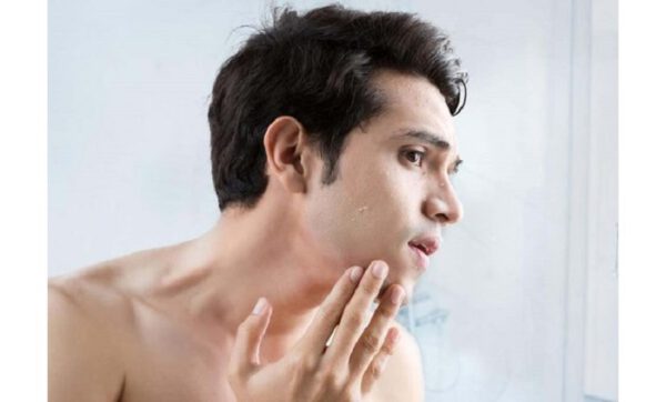 Vị trí mụn phổ biến nhất thường gặp của nam giới thường xuất hiện là mặt, lưng và ngực.