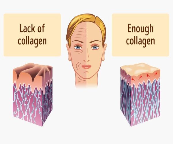 Chất lượng collagen sẽ giảm đi theo thời gian.