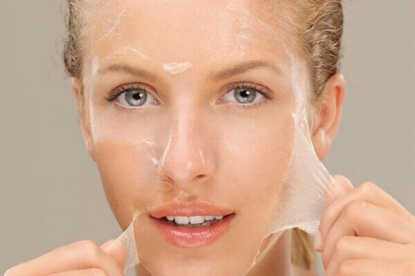 Áp dụng phương pháp peel vào điều trị nám da làm trắng sáng hiệu quả. - serum trị nám trắng da