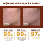 Kem nghệ Oriss
