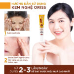 Kem nghệ Oriss
