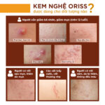 Kem nghệ Oriss