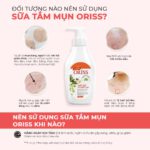 Sữa tắm ngừa mụn Oriss