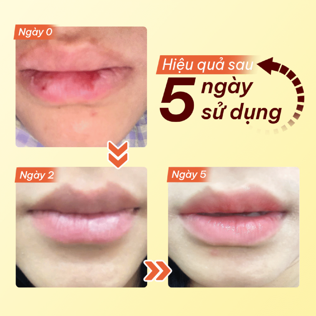 Son duong 12