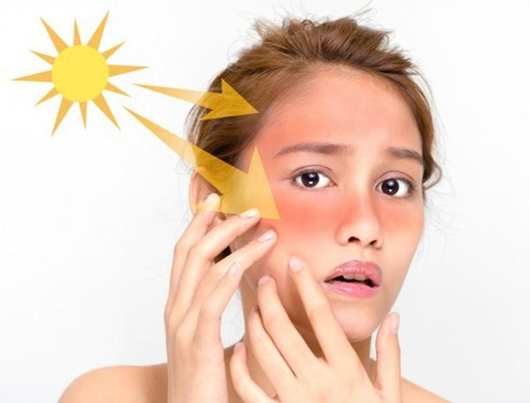 Không chống nắng kĩ khi dùng vitamin C khiến da dễ bị sạm đen