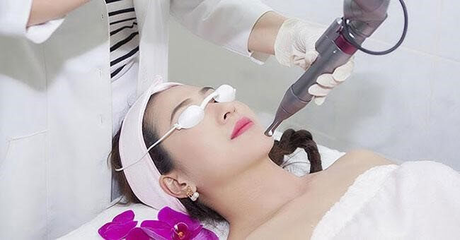 Laser là phương pháp hiệu quả nhất để điều trị nám hiện nay