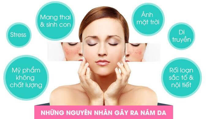 Những nguyên nhân chính gây nám da - bị nám da mặt phải làm sao