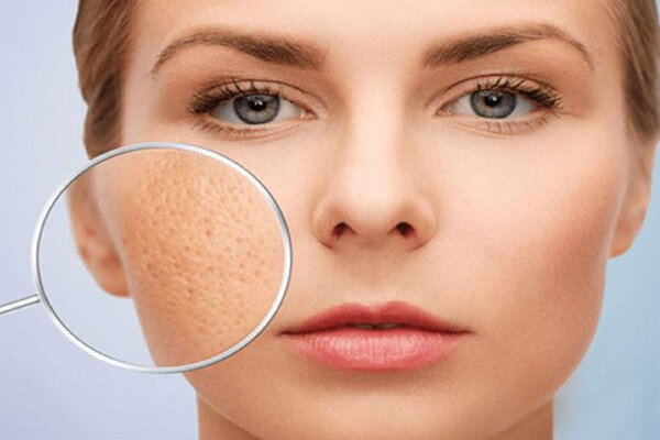 Những vấn đề của lỗ chân lông luôn khiến chúng ta đau đầu trong cách khắc phục - serum dưỡng trắng da se khít lỗ chân lông