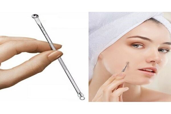 Sử dụng dụng cụ nặn mụn đầu tròn giúp xử lý mụn đầu đen dễ dàng