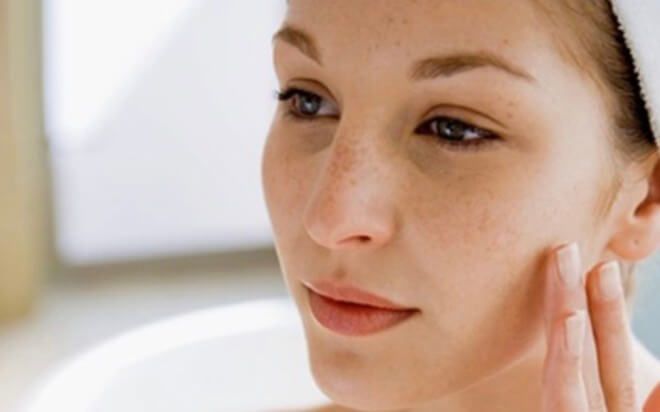 Những vết thâm sạm trên da khiến phụ nữ sau sinh tự ti - chăm sóc da mặt sau sinh