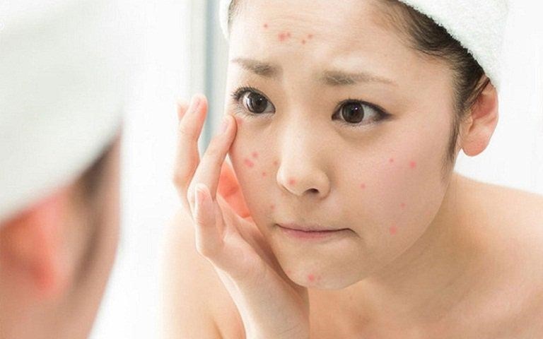 Da khô sau khi rửa mặt là một nguyên nhân dẫn đến tình trạng lão hóa -sữa rửa mặt làm khô da